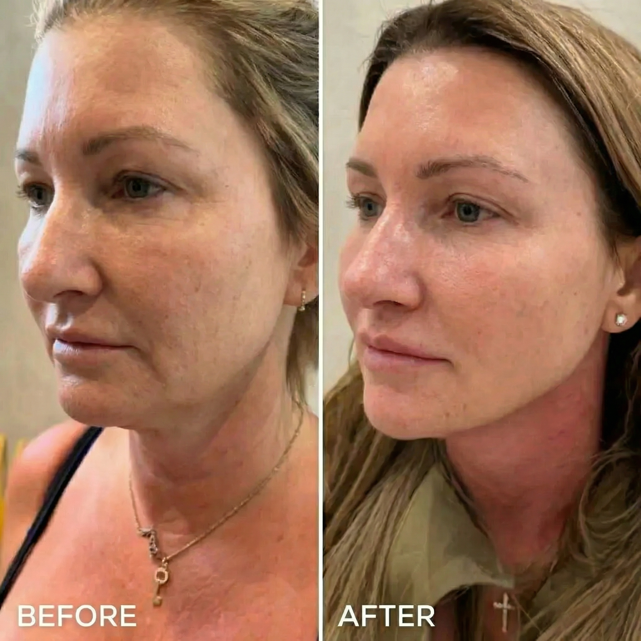 Valento Studio Facebook ad: Read This If You Feel Like Menopause Is Taking Over Your…