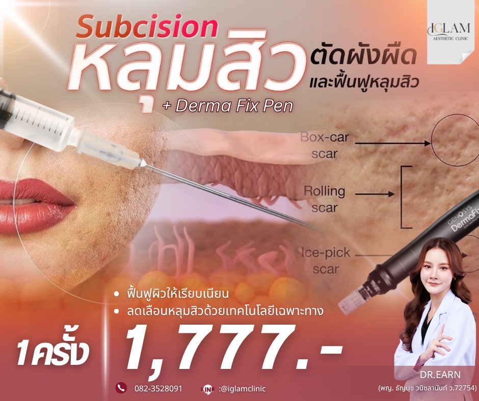 Iglam clinic ระยอง ฟิลเลอร์ โบท็อก Facebook ad