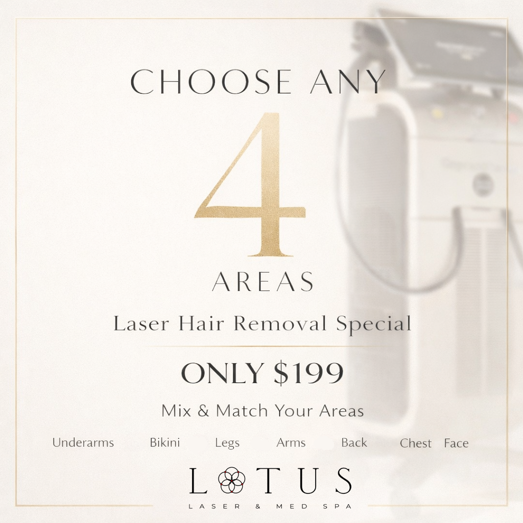 Lotus Laser & Med Spa Facebook ad: Choose ANY 4 Areas, $199
