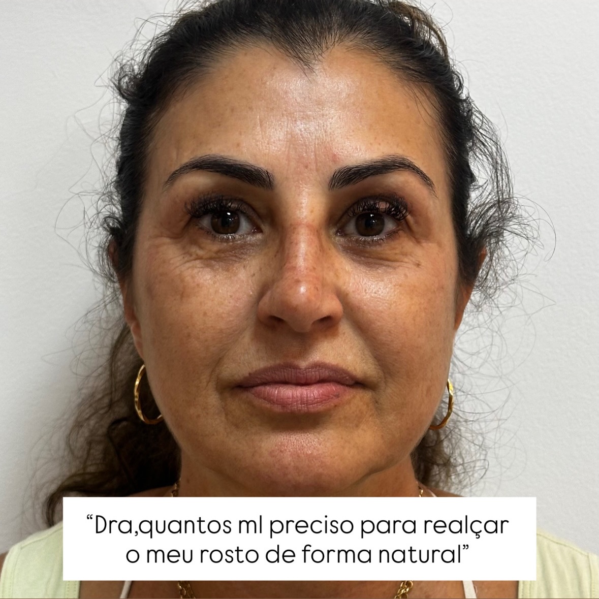Dra. Carol Silva Facebook ad: Você talvez já tenha feito, ou pensado em…