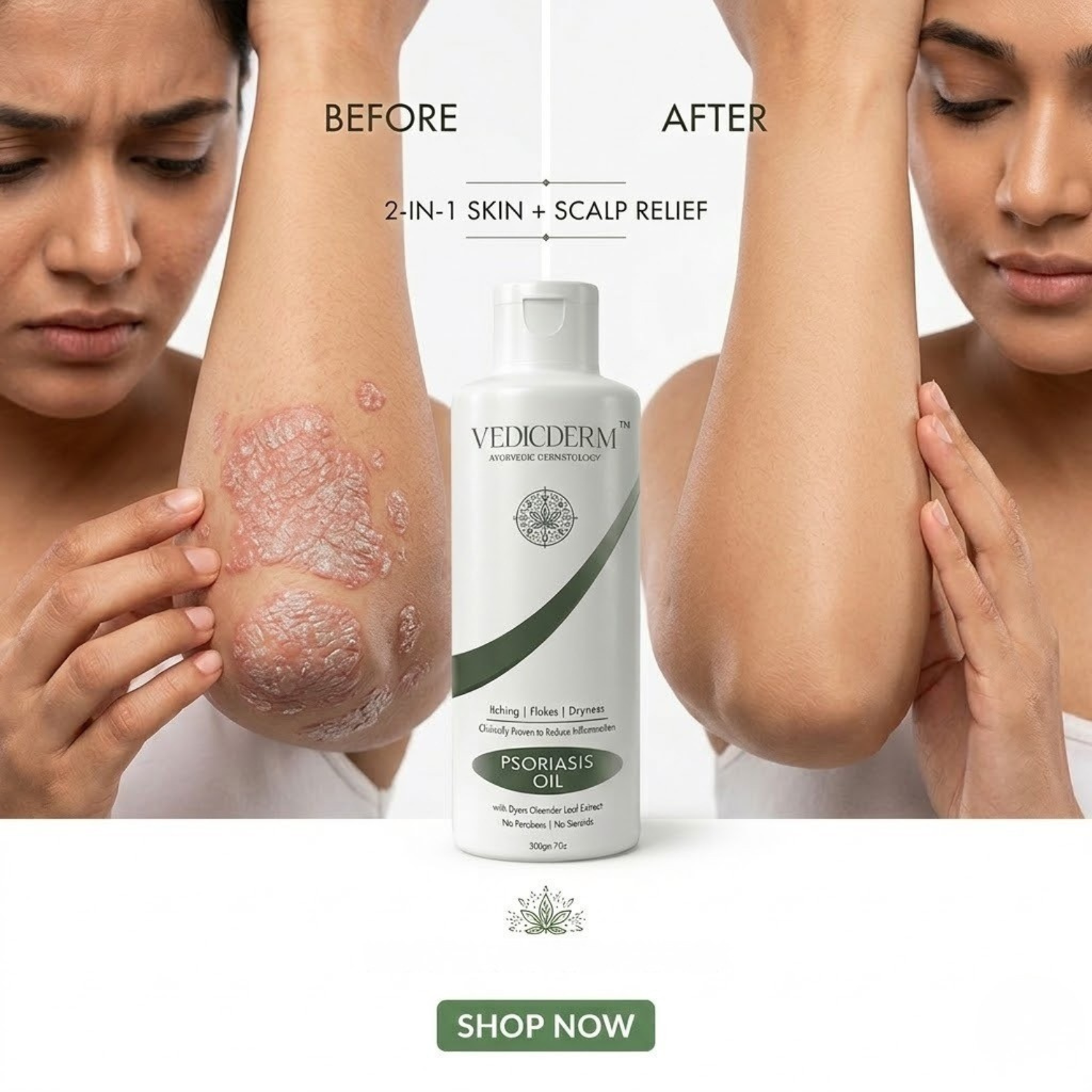 VedicDerm Facebook ad