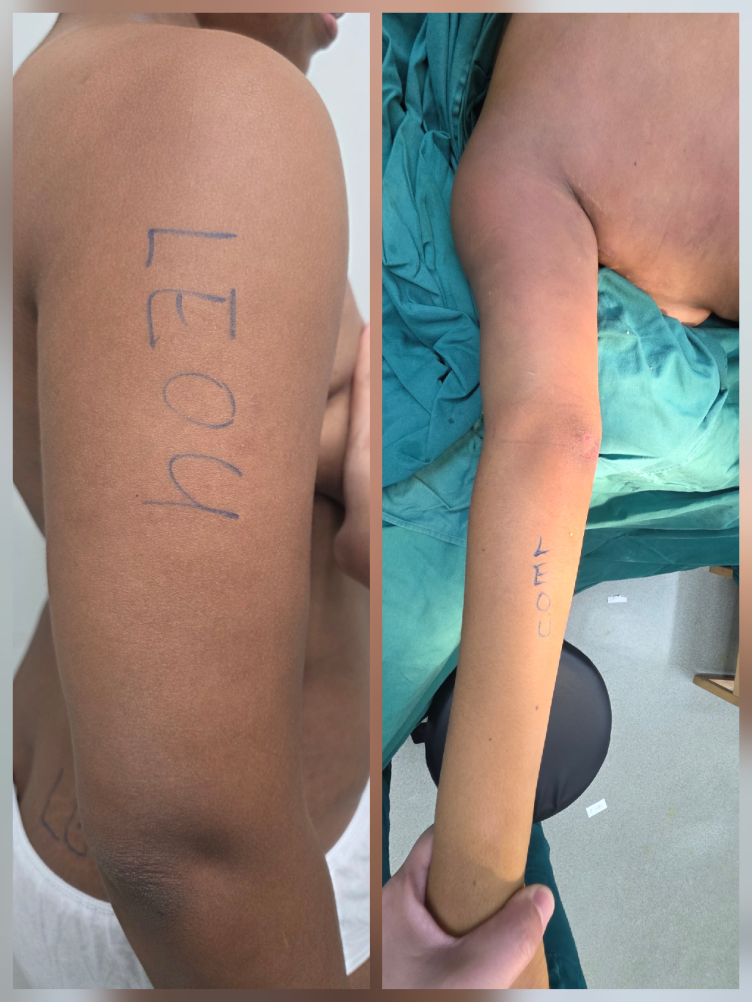 Leoplasticsurgery_Dr.team Facebook ad: LEOU Ligugu Brand Value System