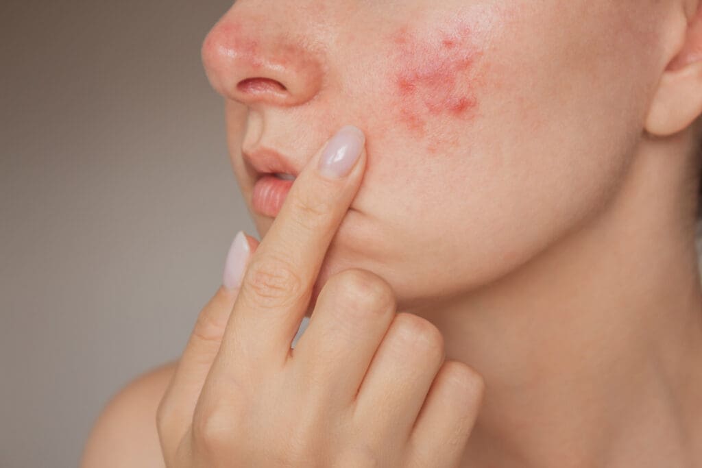 ZO Skin Health Magyarország Facebook ad