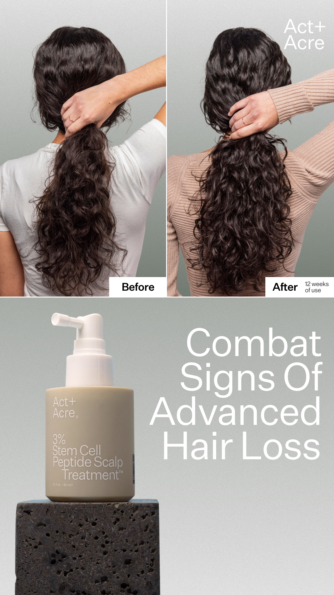 ActandAcre Facebook ad