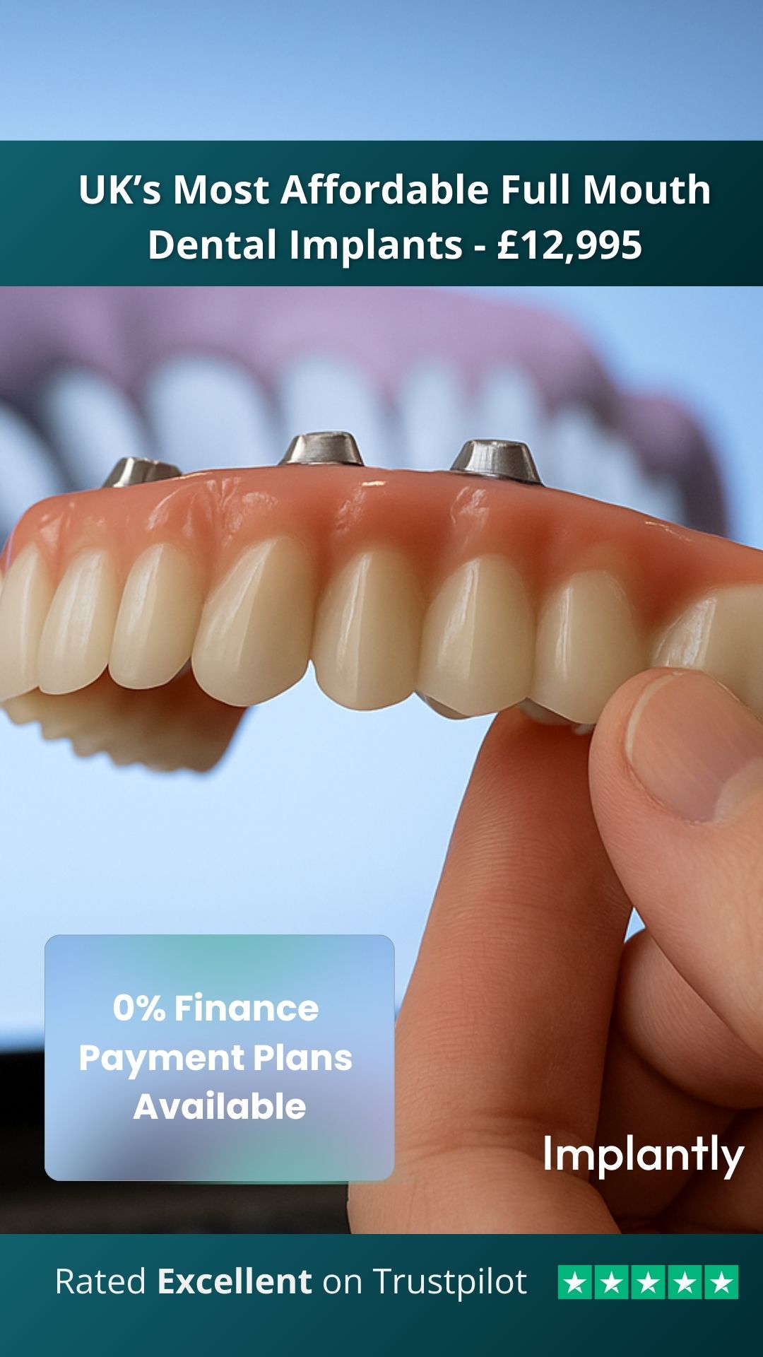 Implantly UK Facebook ad from Feb 13, 2026