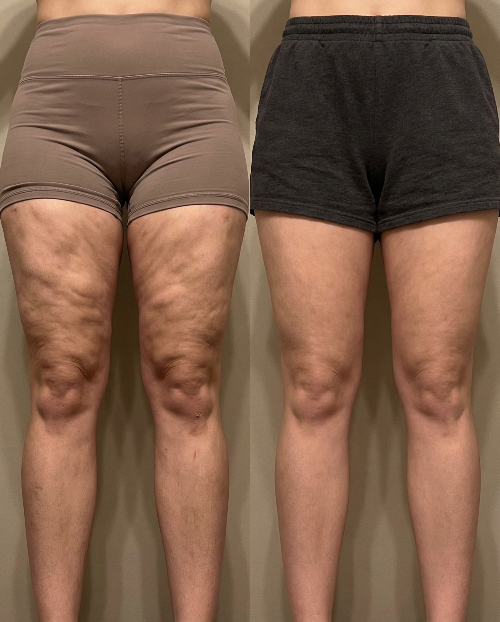 Daily Body Health Facebook ad