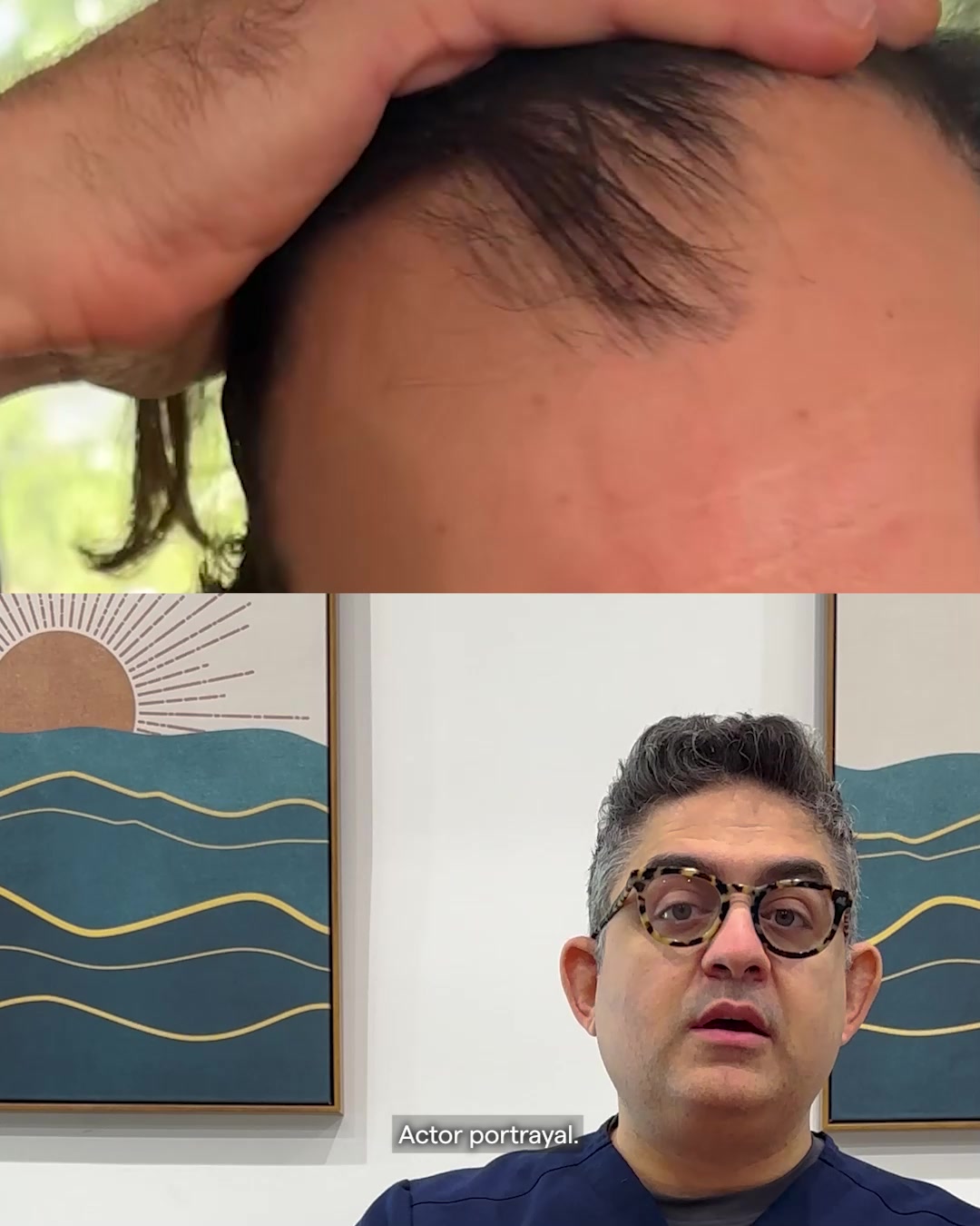 Happy Head Facebook ad: Max Hair Regrowth Formula