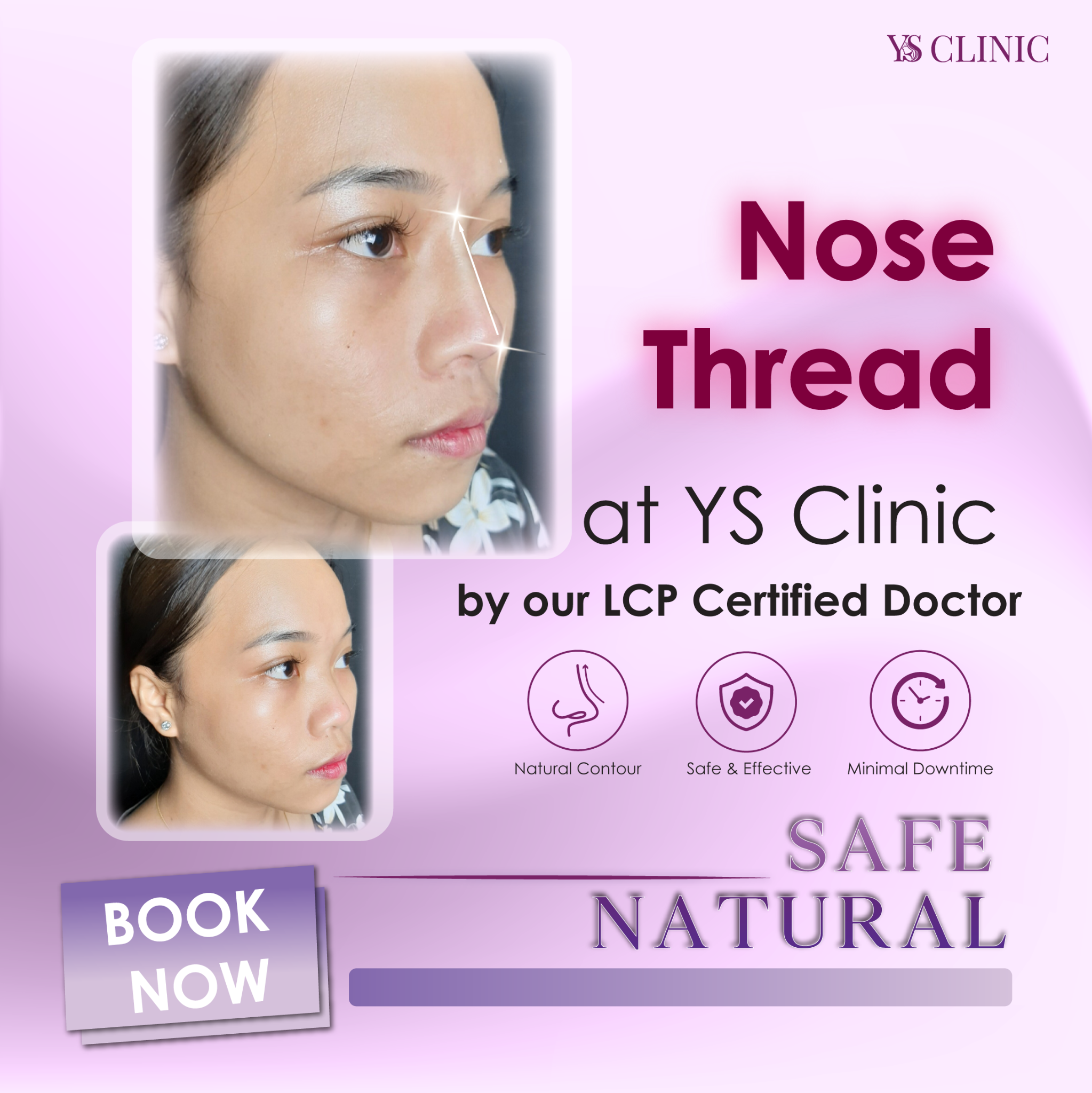 YS Aesthetic Clinic Facebook ad