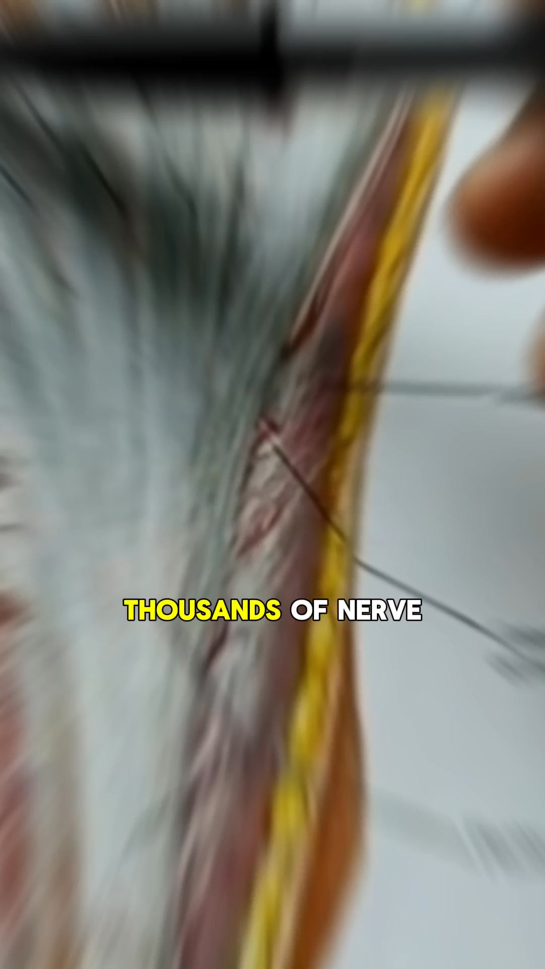 Senzio Facebook ad: There's Hope for Nerve Damage