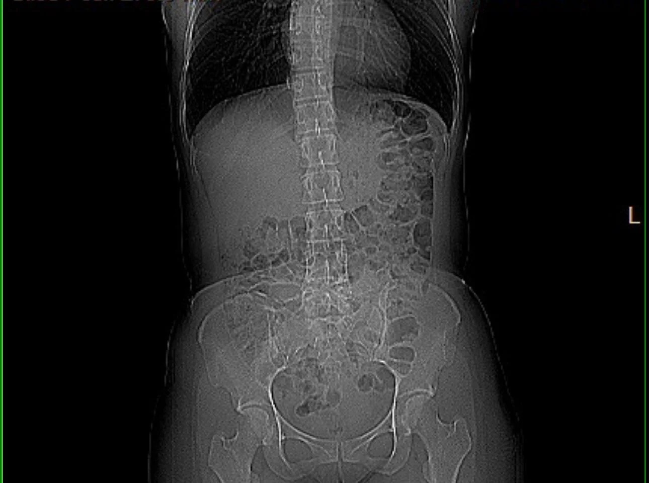 Rachel Bennet Facebook ad: Here's what actually happens when you tell your doctor you…