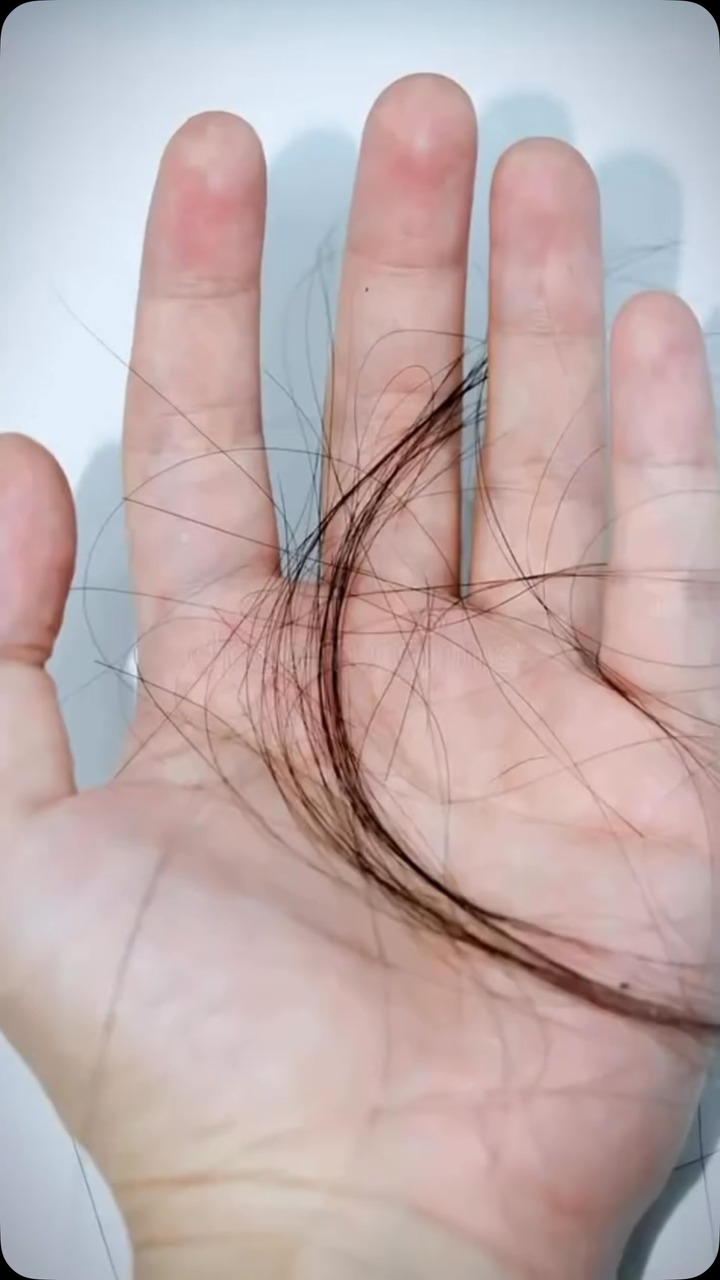 Plix Facebook ad: Hair fall bothering you?