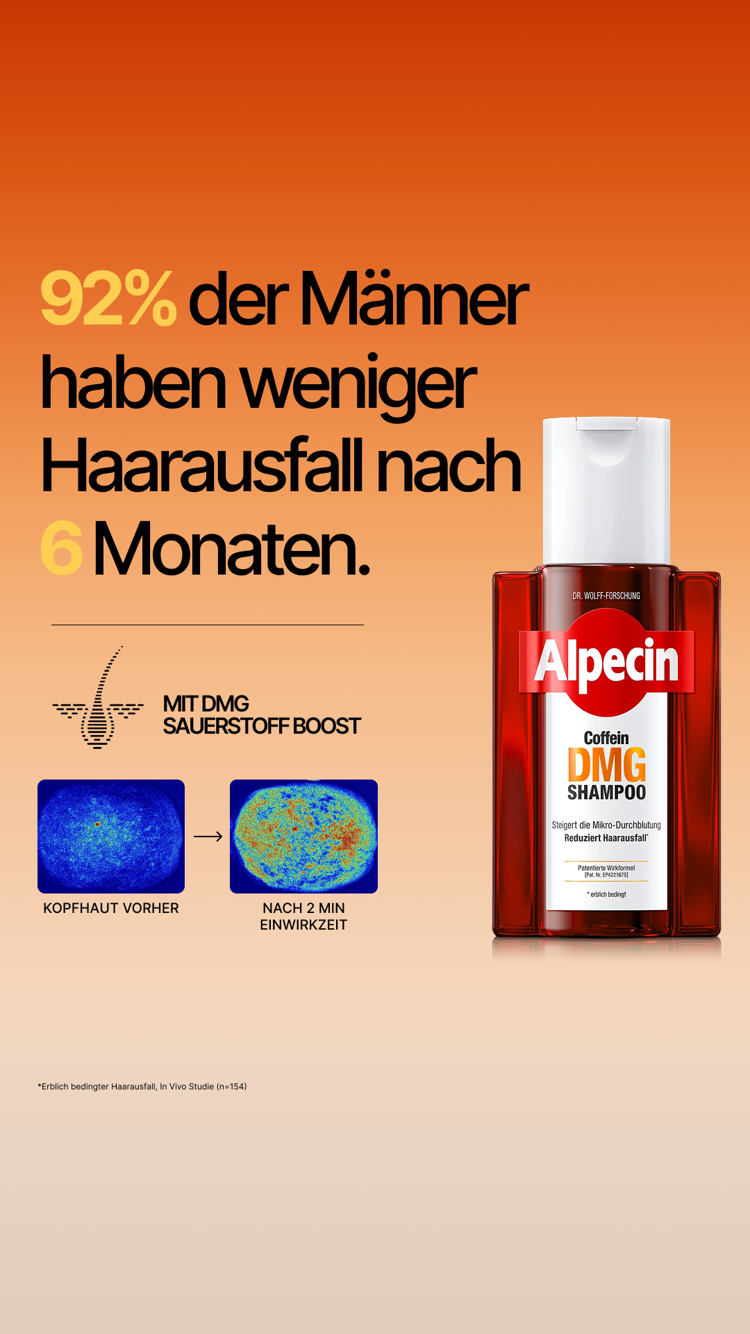 Alpecin Facebook ad