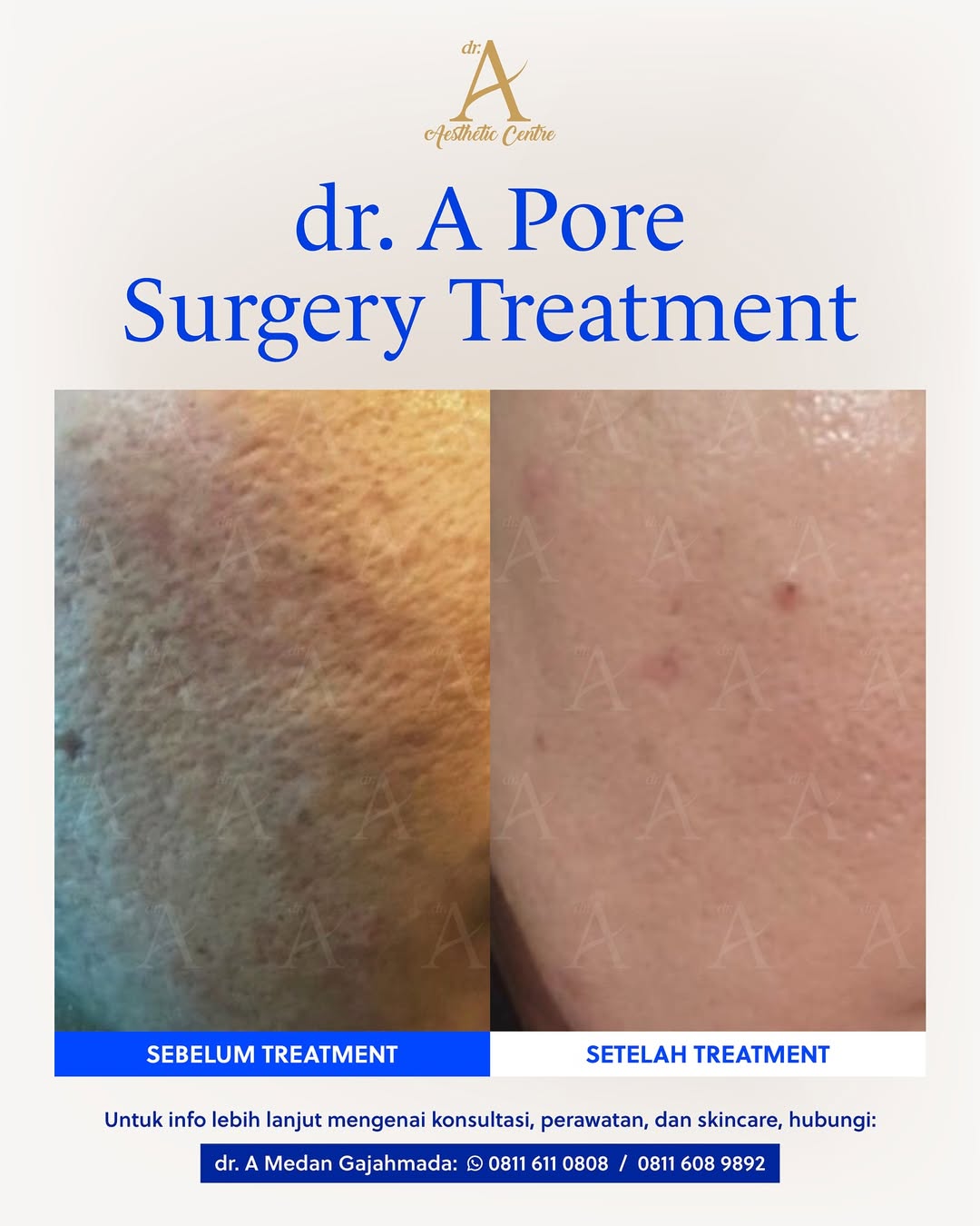 Dr. A Aesthetic Centre Facebook ad