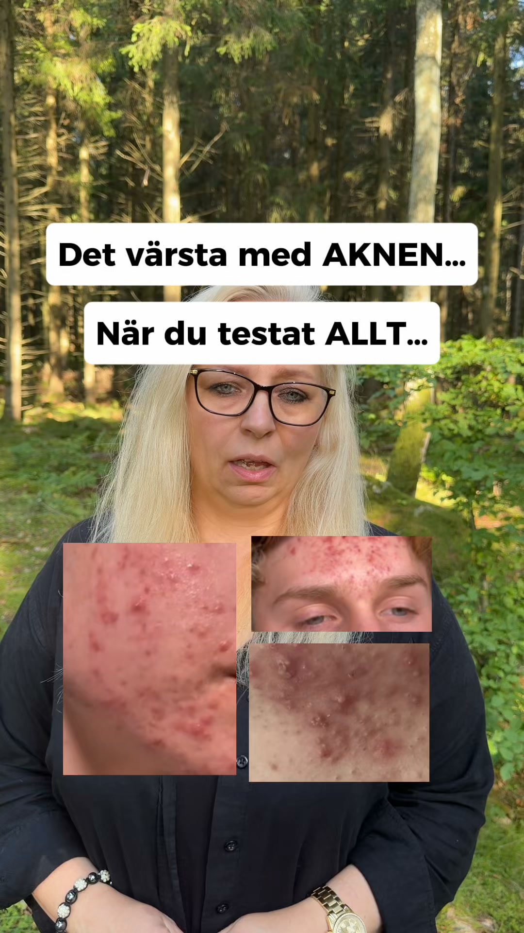 LovieBaby Facebook ad: Naturlig hudvård för akne