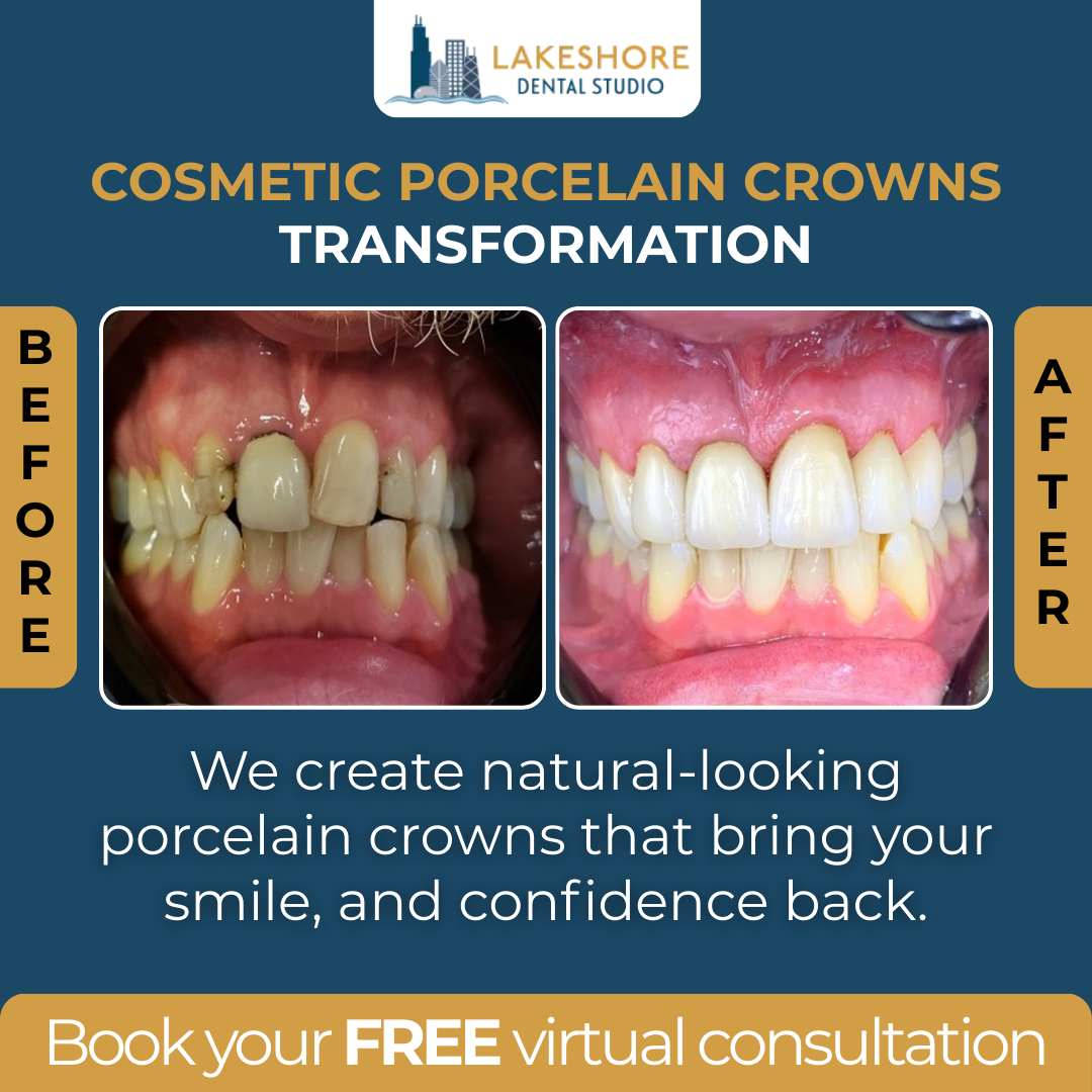 Lakeshore Dental Studio Facebook ad: Start Your Smile Transformation with a FREE Virtual Consult!