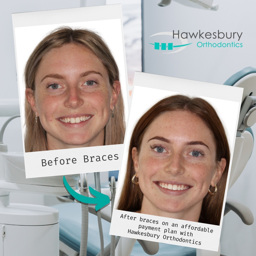 Hawkesbury Orthodontics Facebook ad: Healthy Happy Smiles