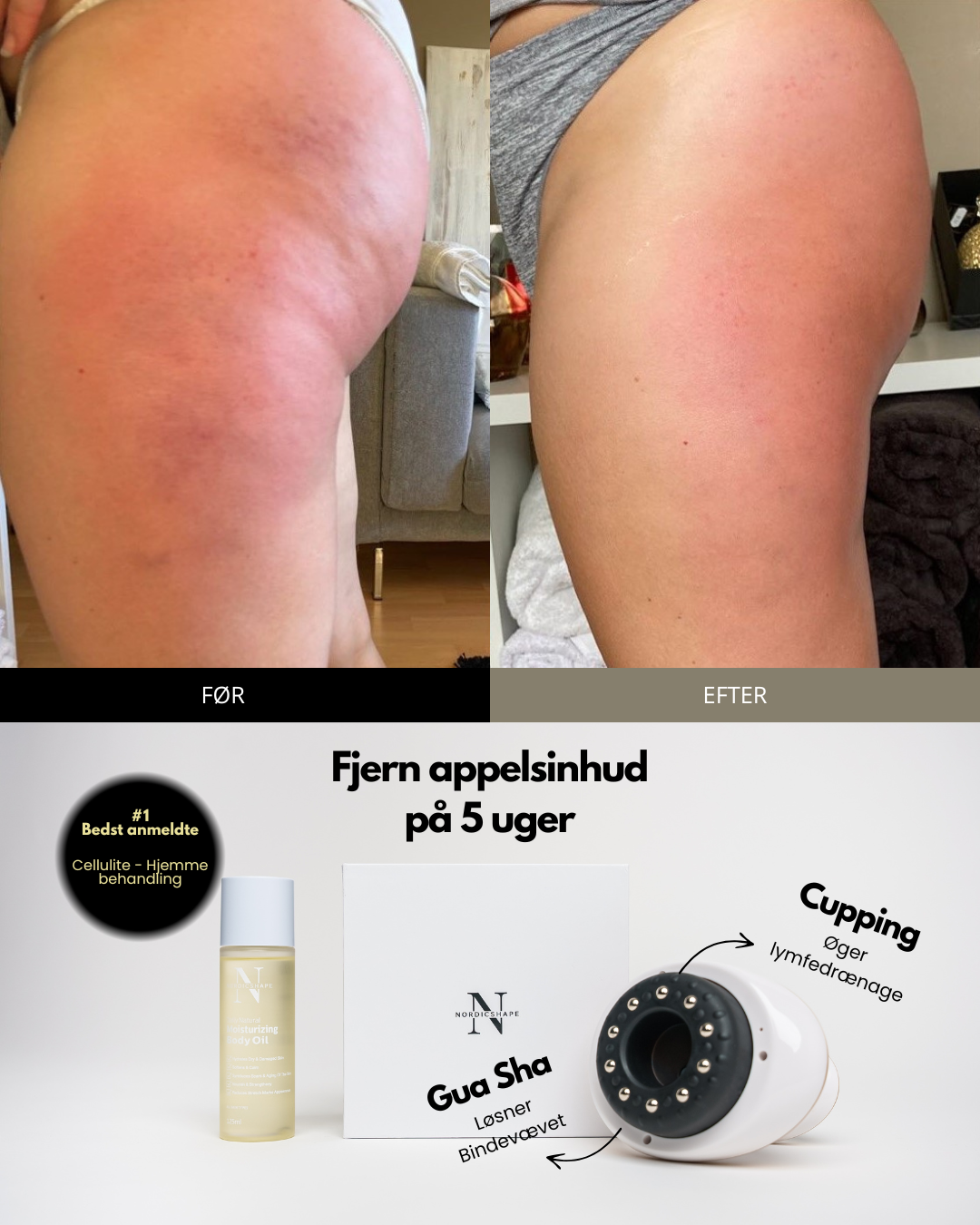 Nordicshape Facebook ad from Sep 19, 2025