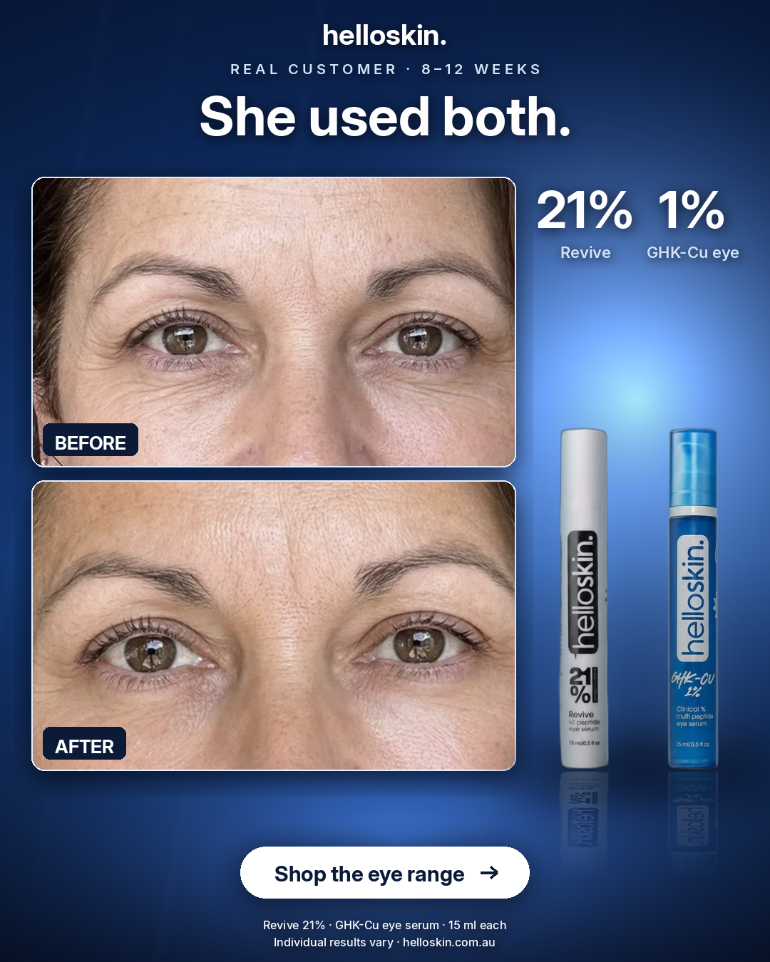 Helloskin Facebook ad: She used both.