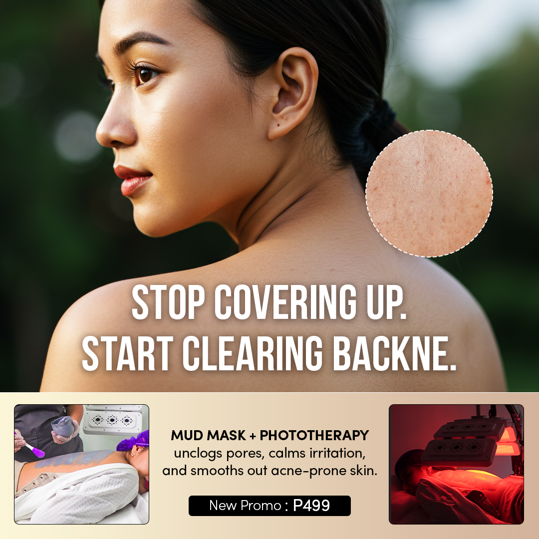 Emanuelle Beauty Facebook ad: P499 Only! | Bye Bye Back Acne
