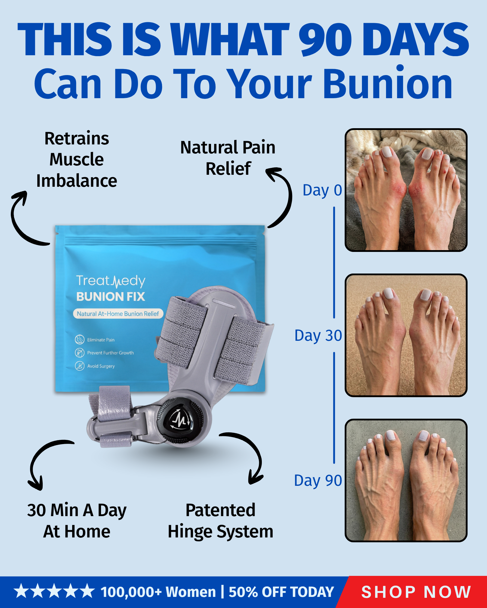Foot Health Insider Facebook ad: Fix Your Bunions Without Surgery