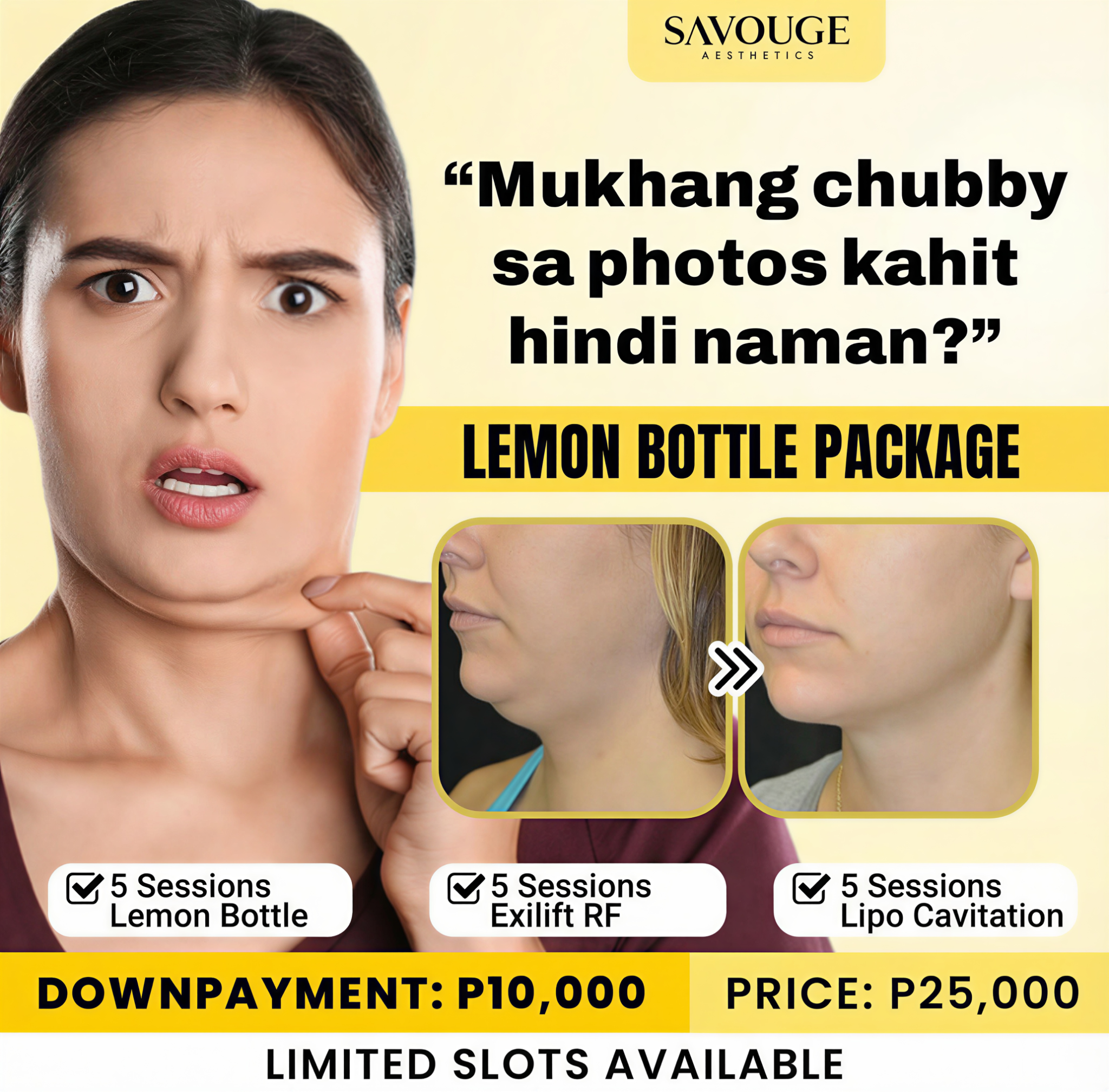 Savouge Aesthetics Philippines Facebook ad
