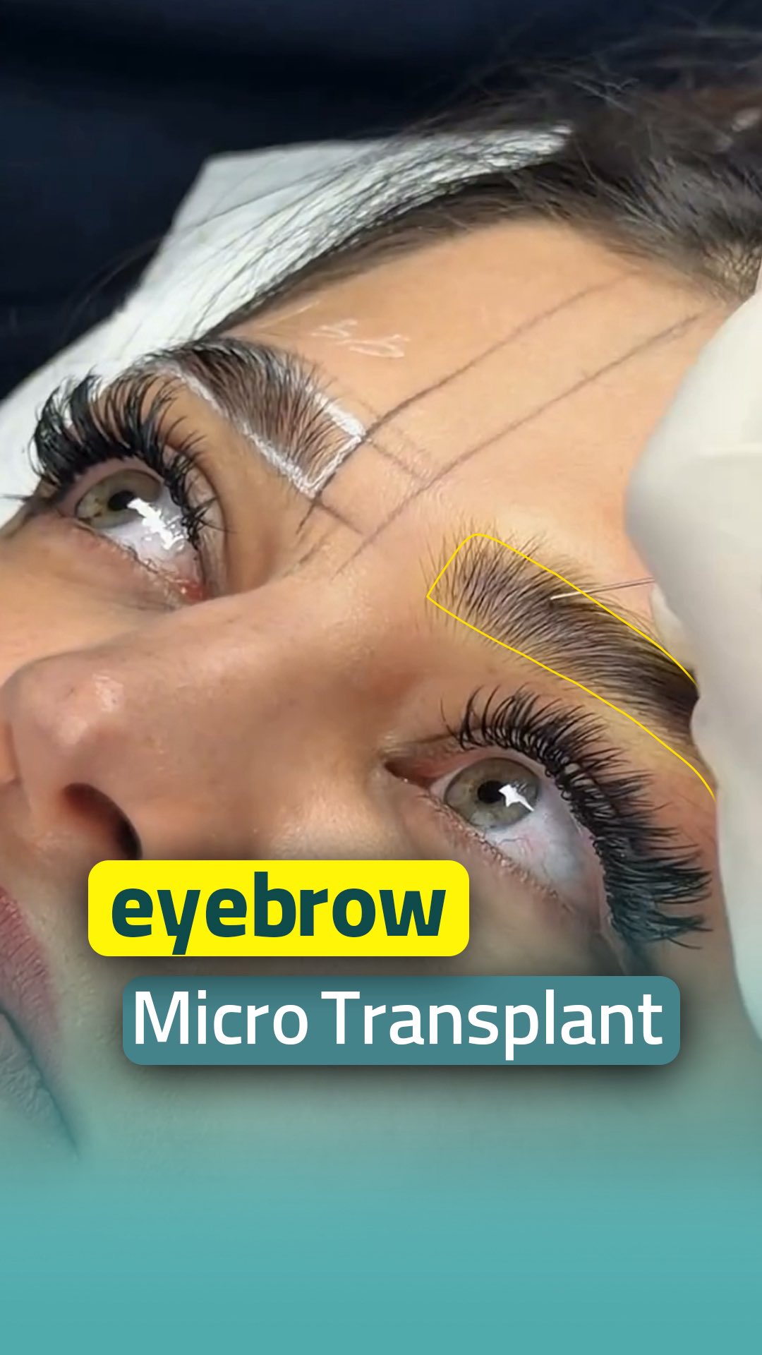 Helia Clinic DUBAI Facebook ad: Perfect Brows. Naturally Beautiful.