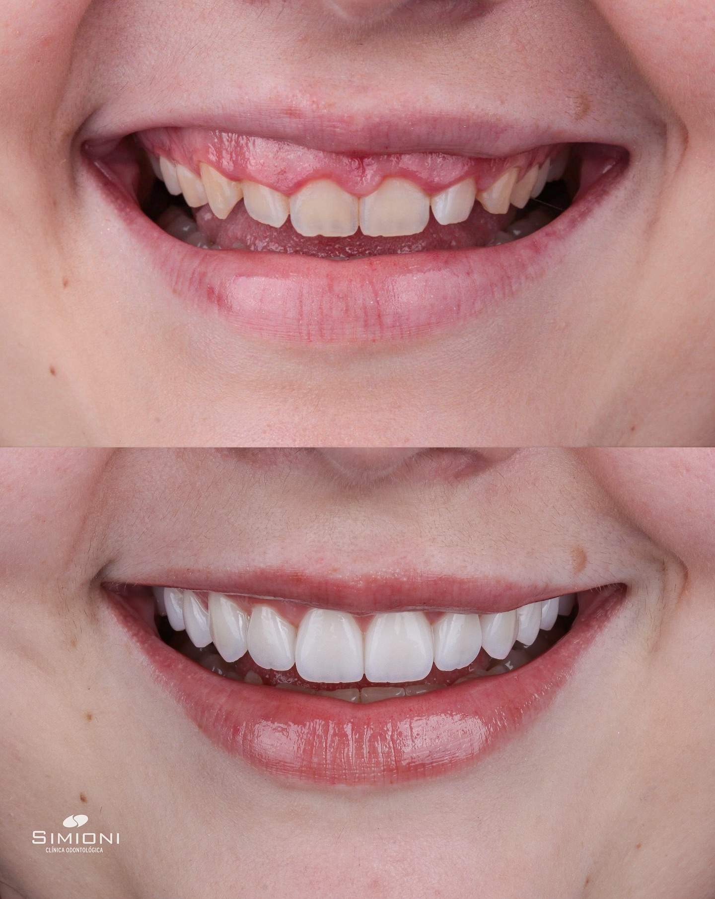 Dr. Sylvio Simioni Facebook ad: Ela não sentia bem com a estética do…