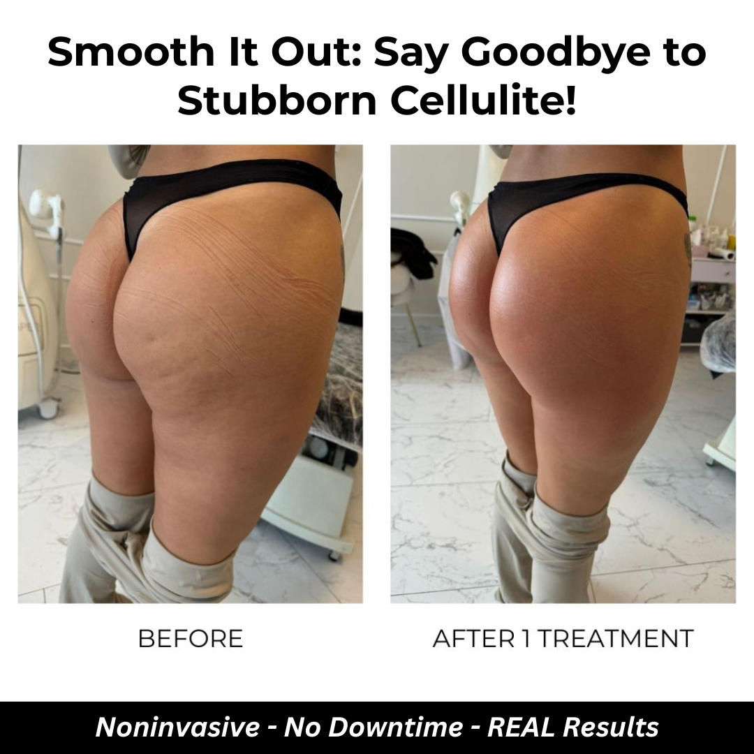 Giovanni Med Spa Facebook ad: Ladies in Gilbert & Surrounding Areas