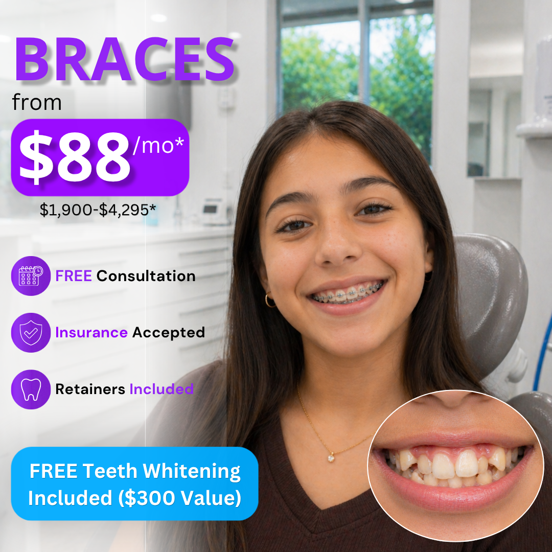 Sun Orthodontist Braces & Invisalign Facebook ad: Braces From $88/mo. FREE Teeth Whitening With Treatment…