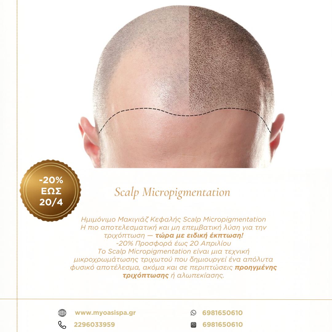 OASIS Υπηρεσίες Ευεξίας & Ομορφιάς Facebook ad: Scalp Micropigmentation