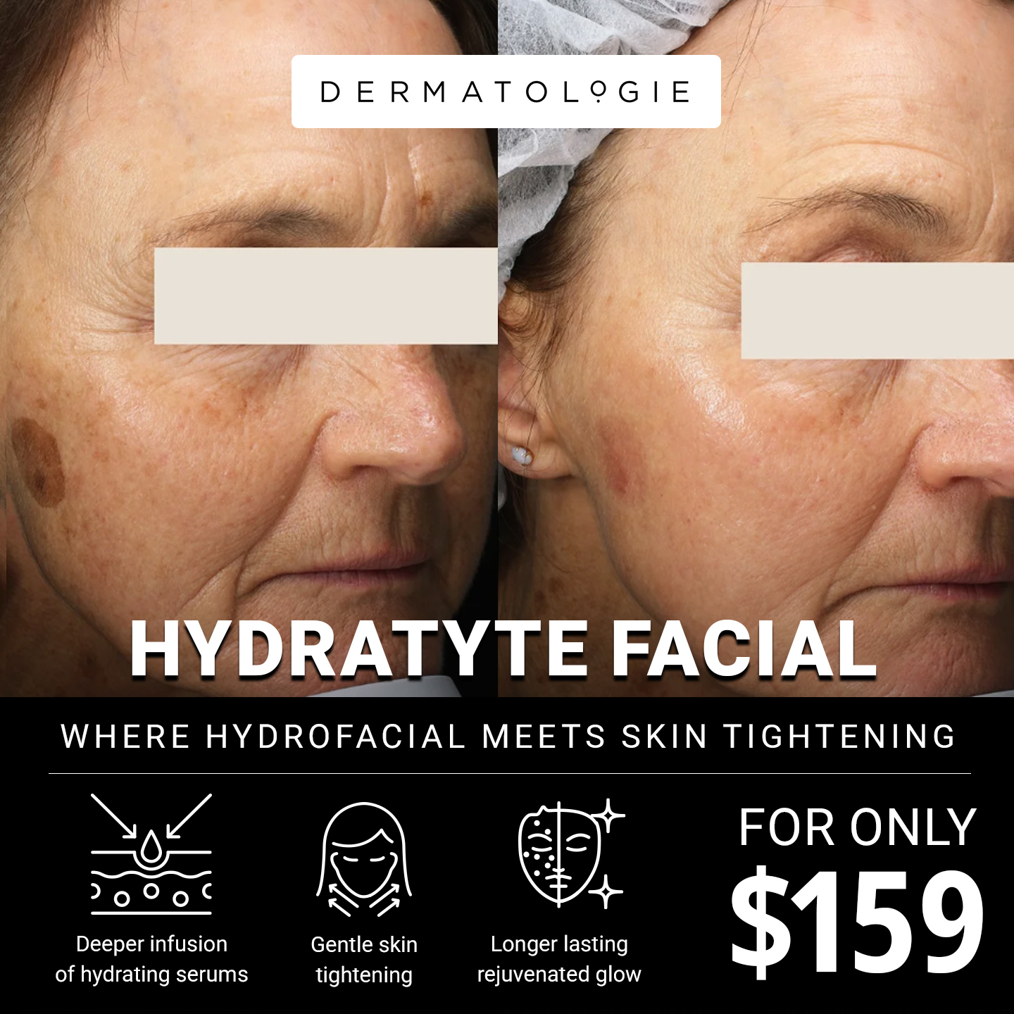 Dermatologie Skin + Hair Solutions Facebook ad: The Glow Facial with a Firming Boost, for Just $159