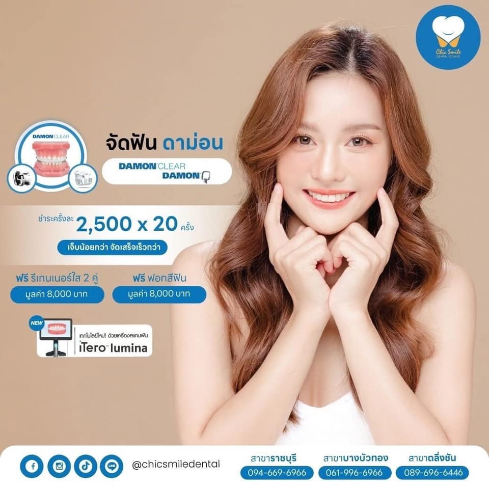 Chic Smile Dental Clinic จัดฟัน รากฟันเทียม วีเนียร์ ราชบุรี บางบัวทอง Facebook ad: โปรโมชั่น จัดฟัน Chic Smile