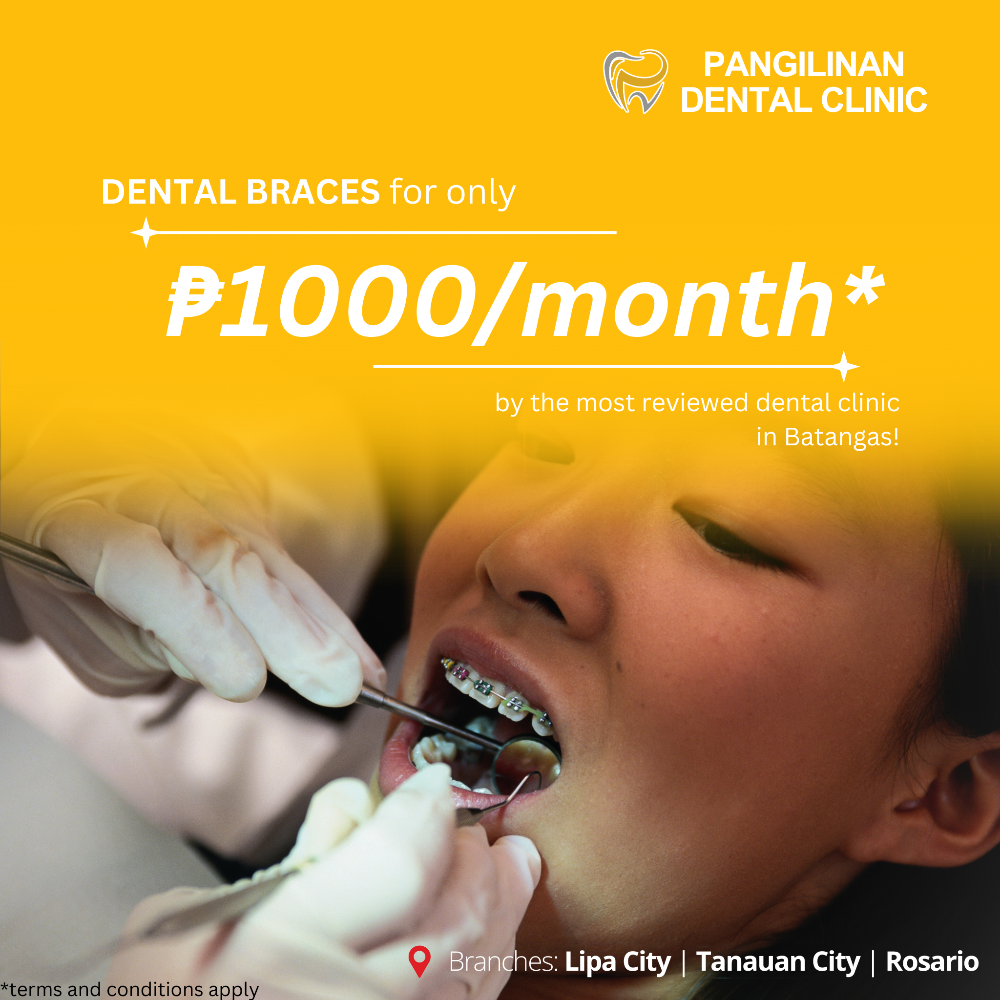 Pangilinan Dental Clinic Rosario Facebook ad