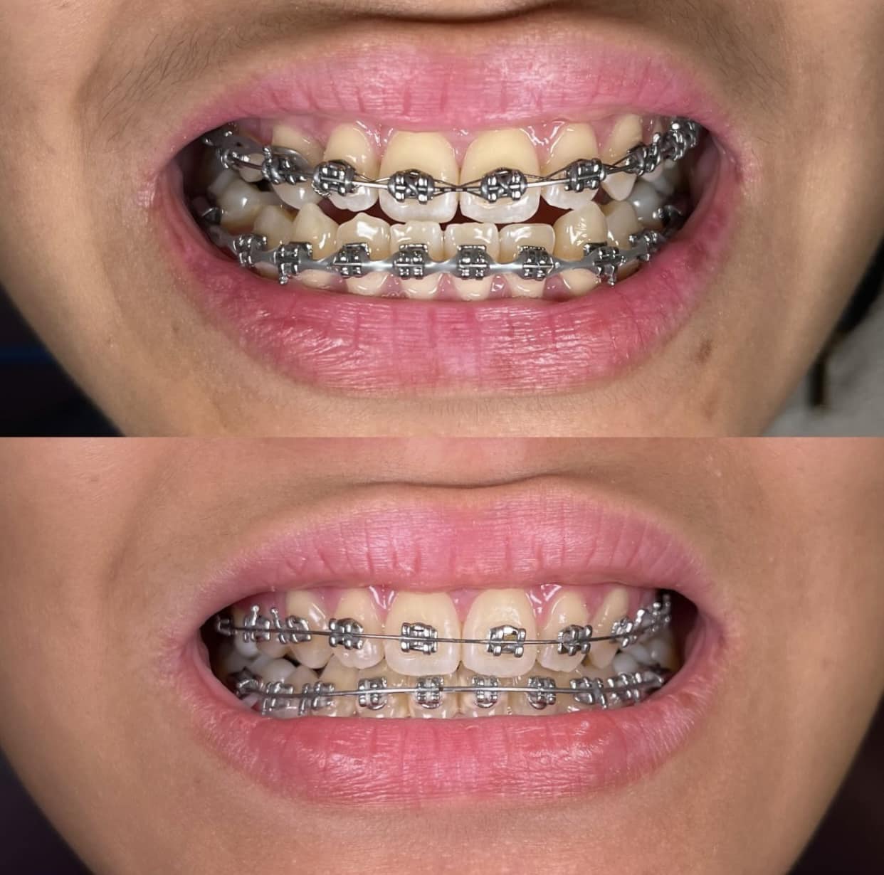 Gonzales Dental Clinic - Matina Facebook ad