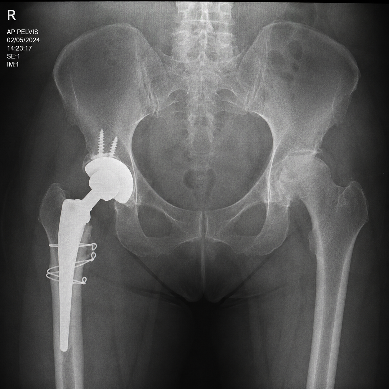 Margaret Johnson Facebook ad: Read This If Hip Pain Is Stealing Your Life