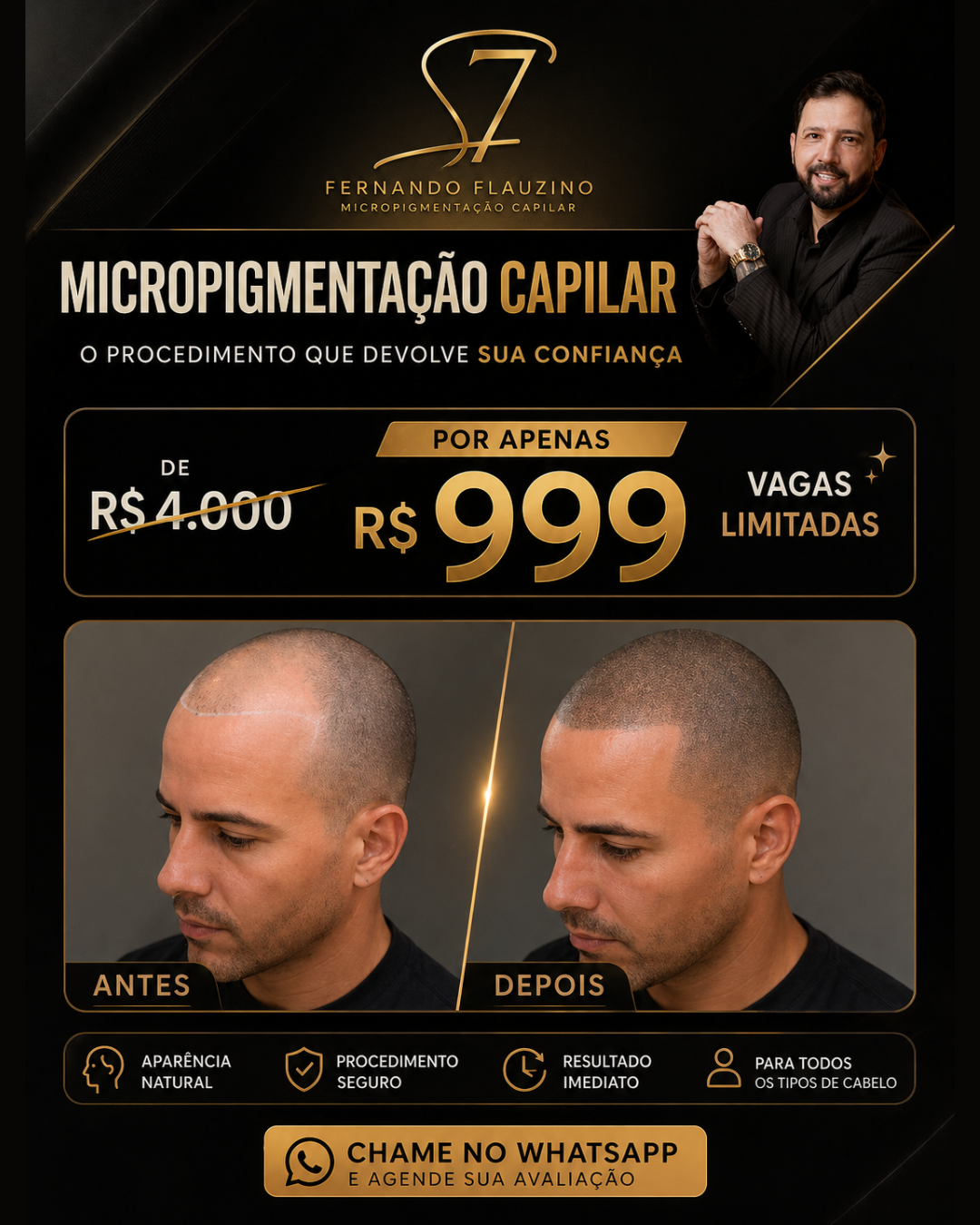 Fernando Flauzino Micropigmentação Capilar Avançada Facebook ad from May 1, 2026