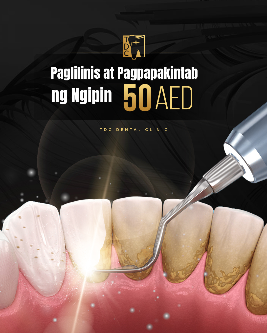 TDC Dental Clinic Facebook ad from Apr 30, 2026