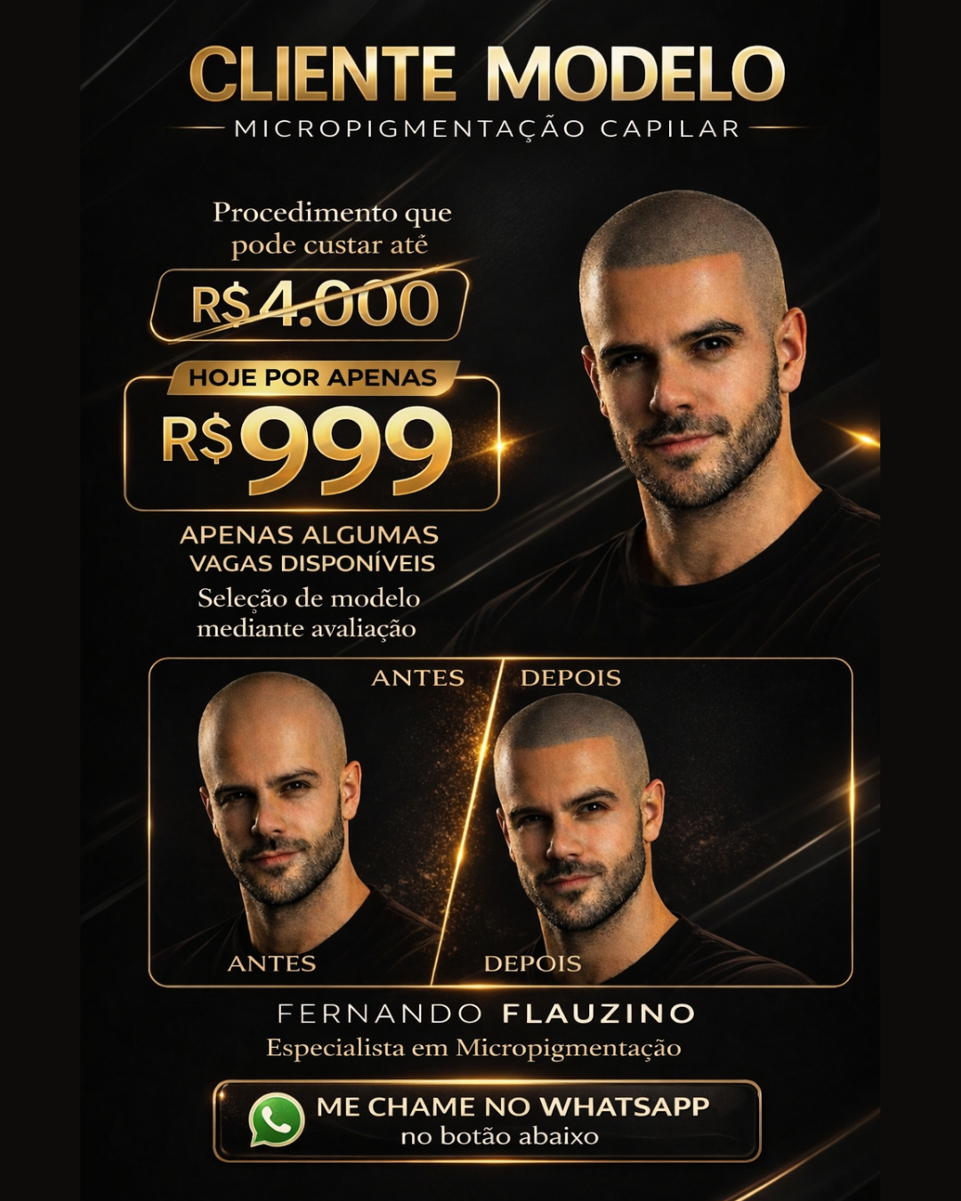 Fernando Flauzino Micropigmentação Capilar Avançada Facebook ad from Apr 15, 2026