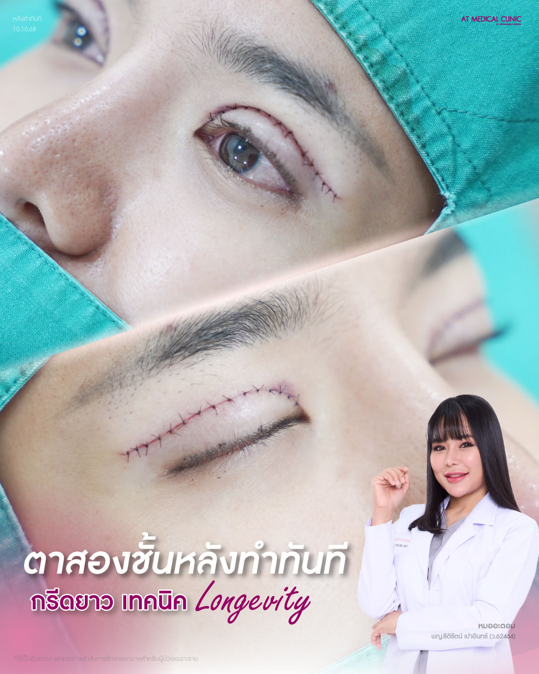 At Medical Clinic สาขา พัทยา Facebook ad