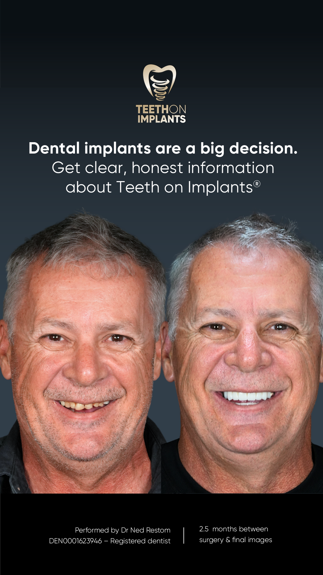 Delroy Park Dental Care Facebook ad from Apr 23, 2026