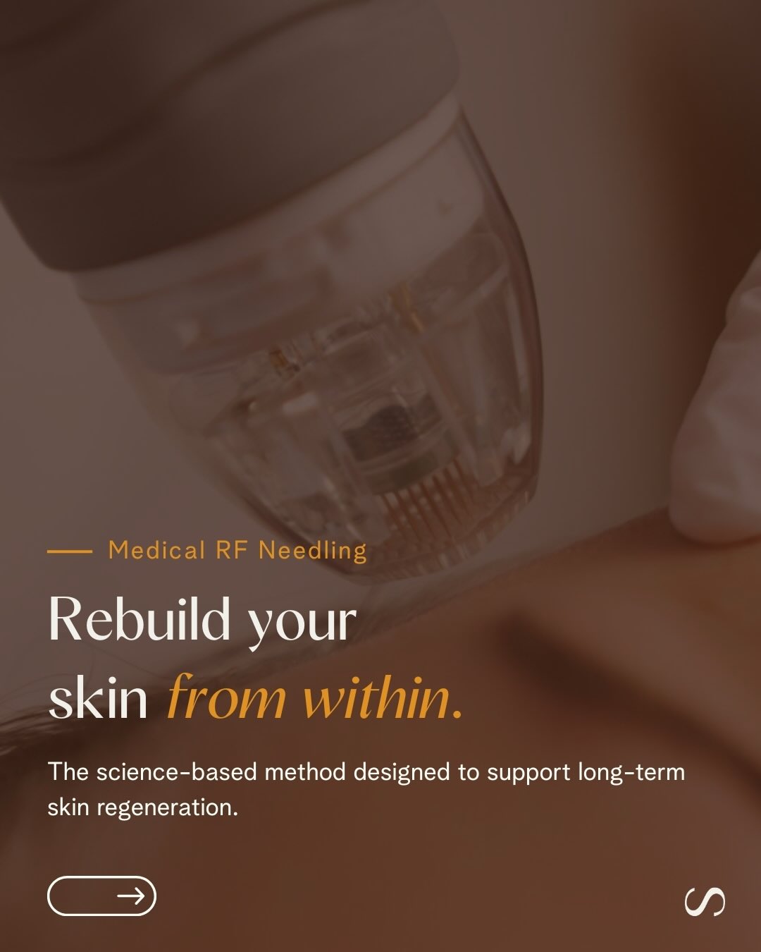 Everskin Facebook ad: Medical Radiofrequency Needling is a science-based method…