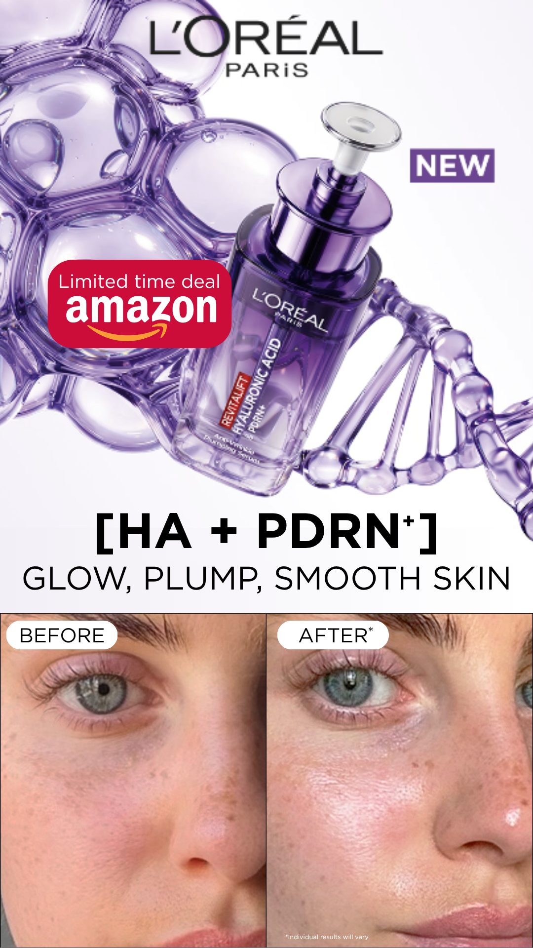 L'Oréal Paris Facebook ad