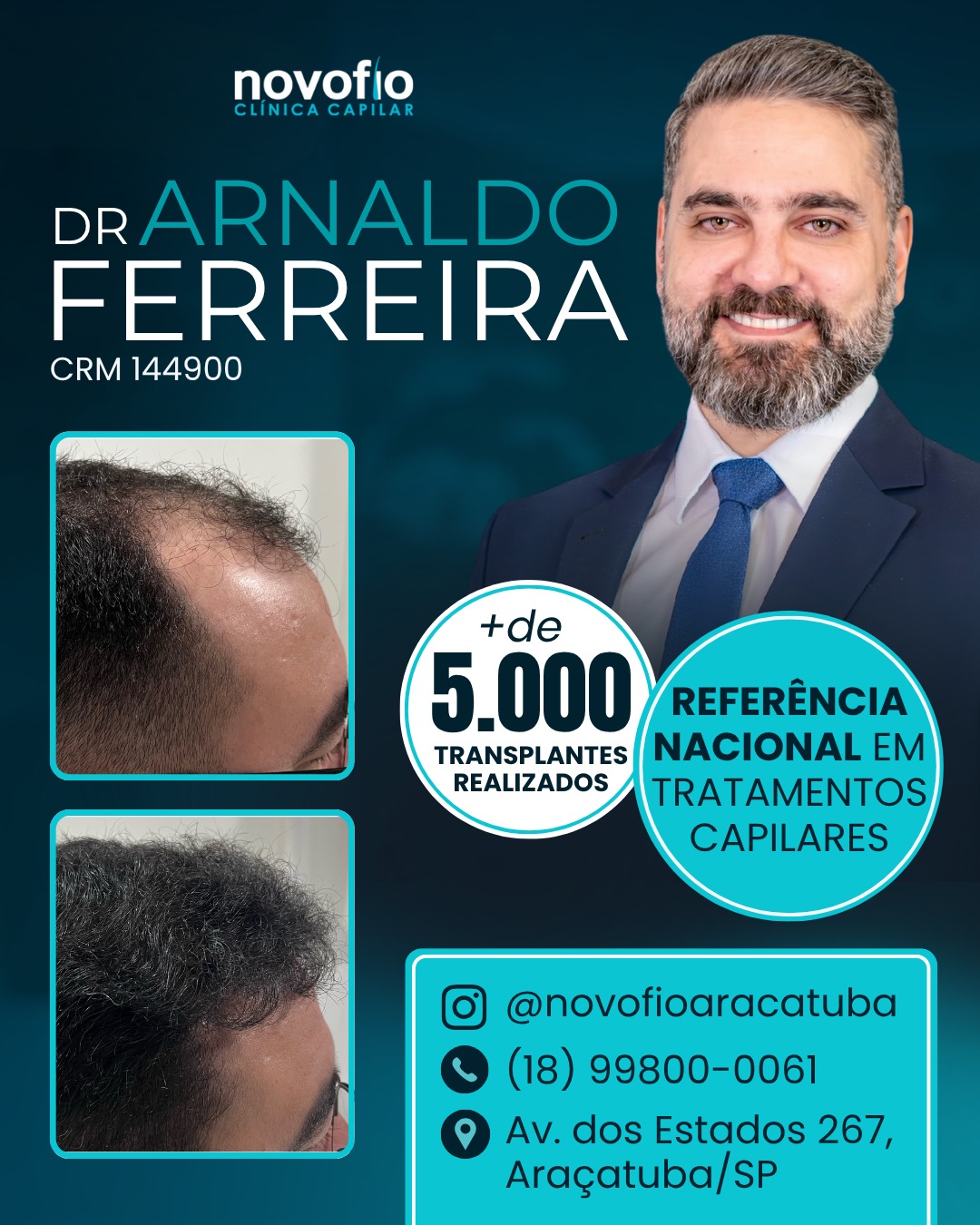 Novofio Araçatuba Clínica Capilar Facebook ad
