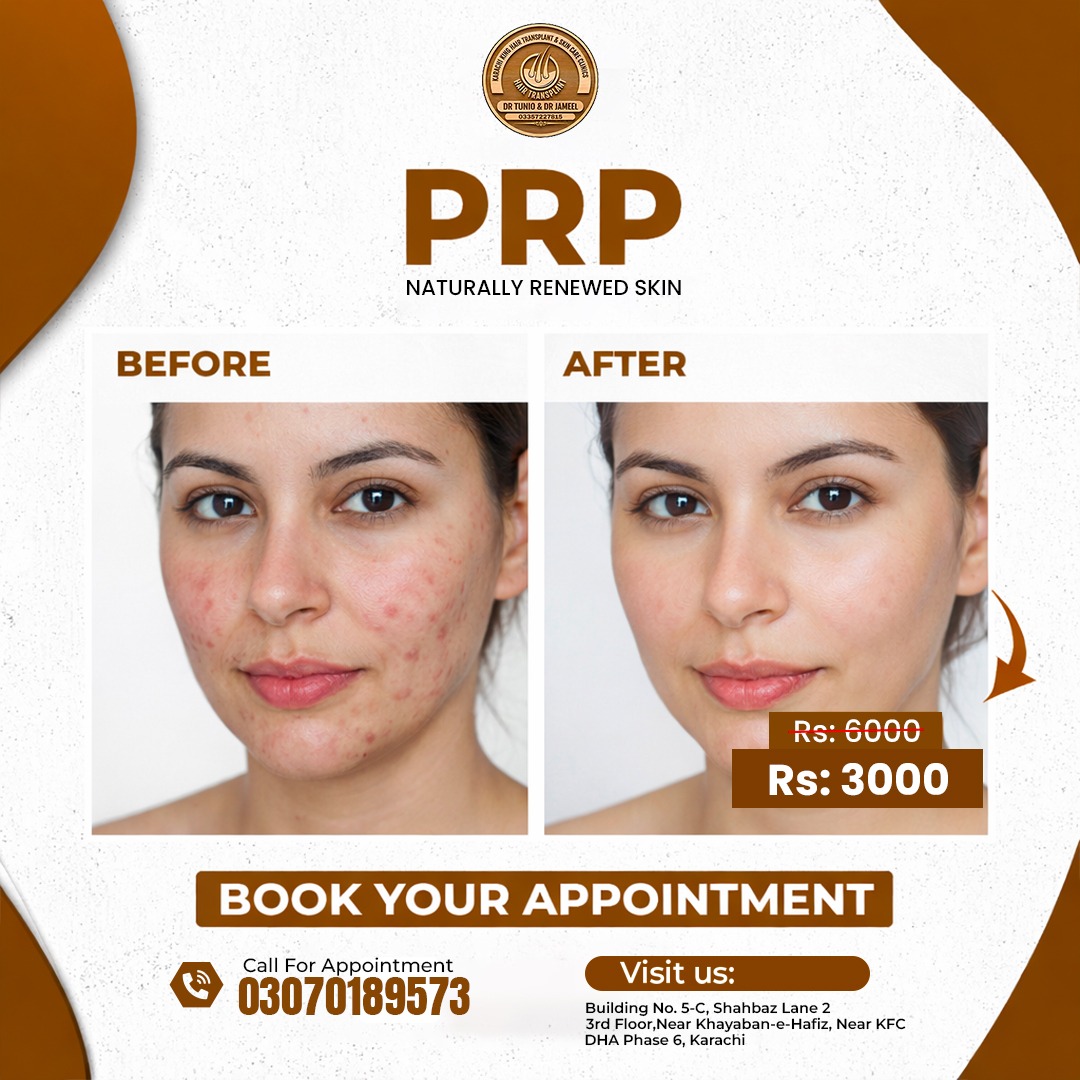 Karachi king skin care & hair transplant Facebook ad