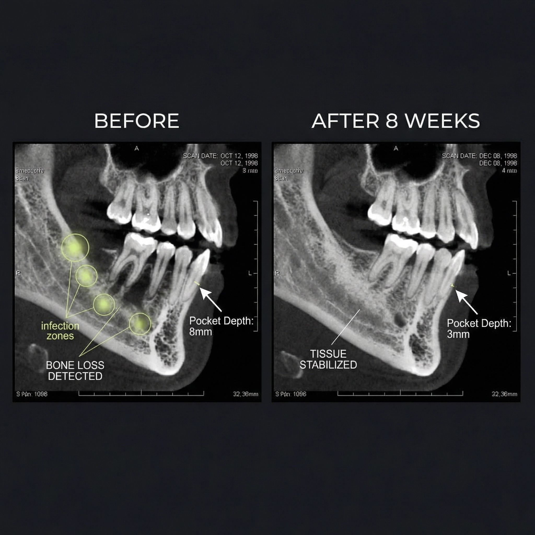 Receding Gums Reset Facebook ad
