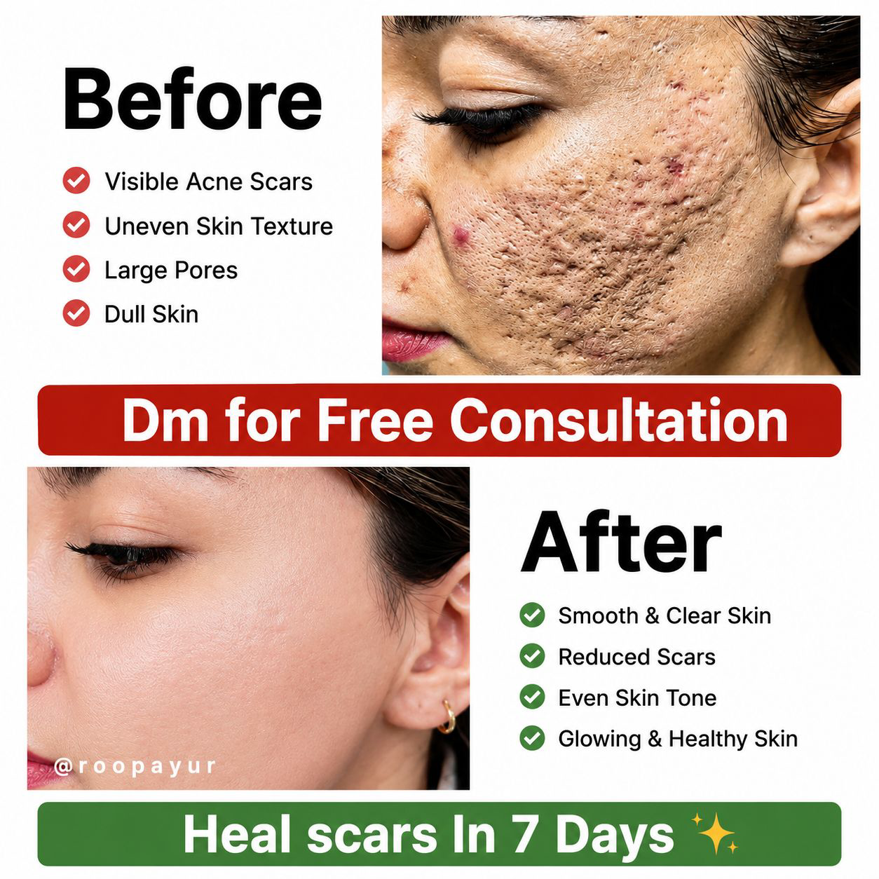 Zomedico Facebook ad: Free Consultation