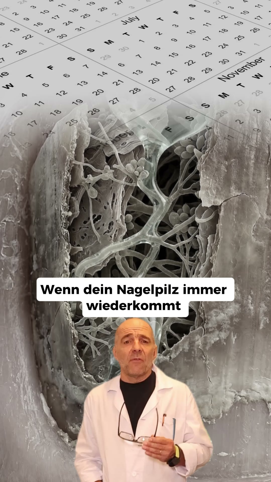 Nagelpilz Ratgeber Facebook ad: Der größte Fehler bei Nagelpilz