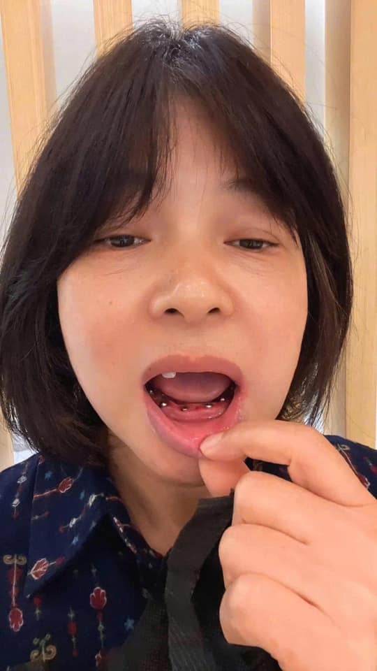 Delia Dental Clinic Facebook ad