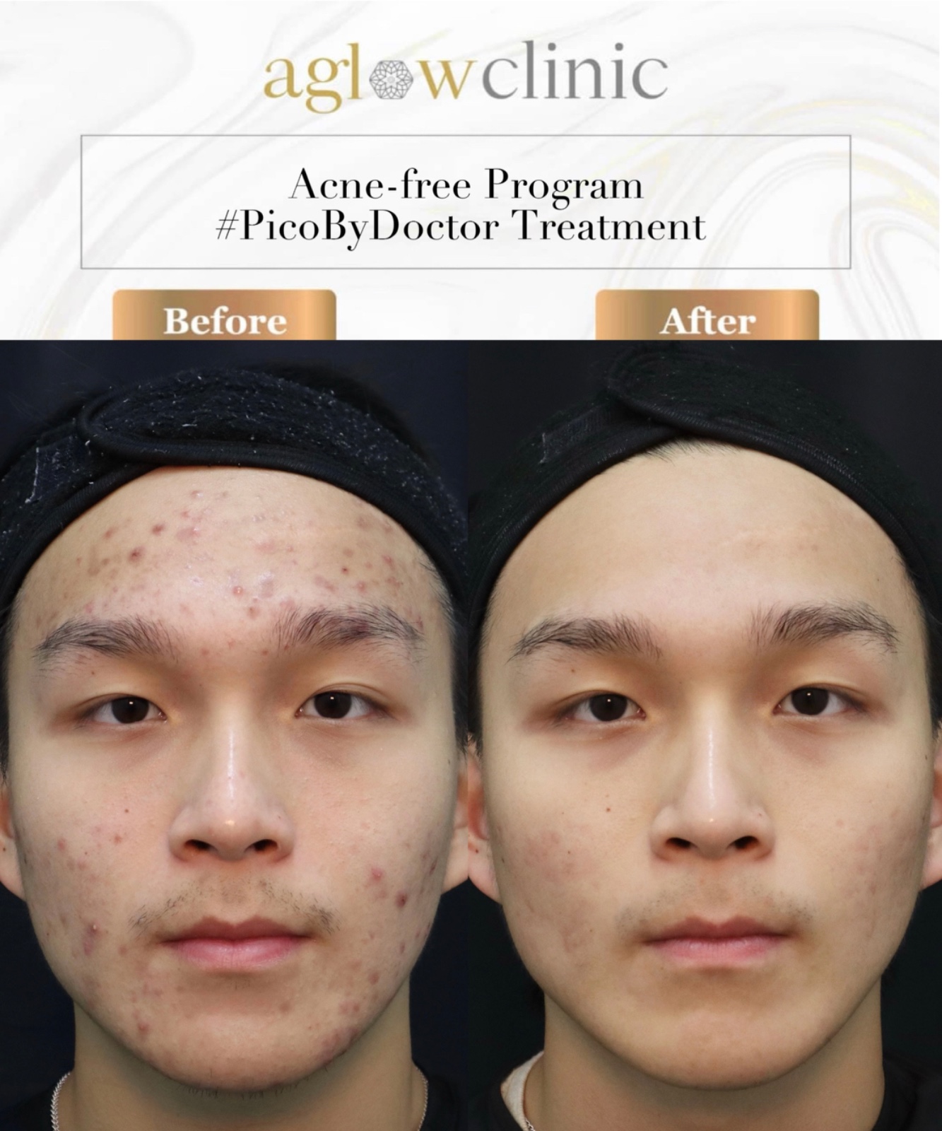 Aglow Clinic Facebook ad