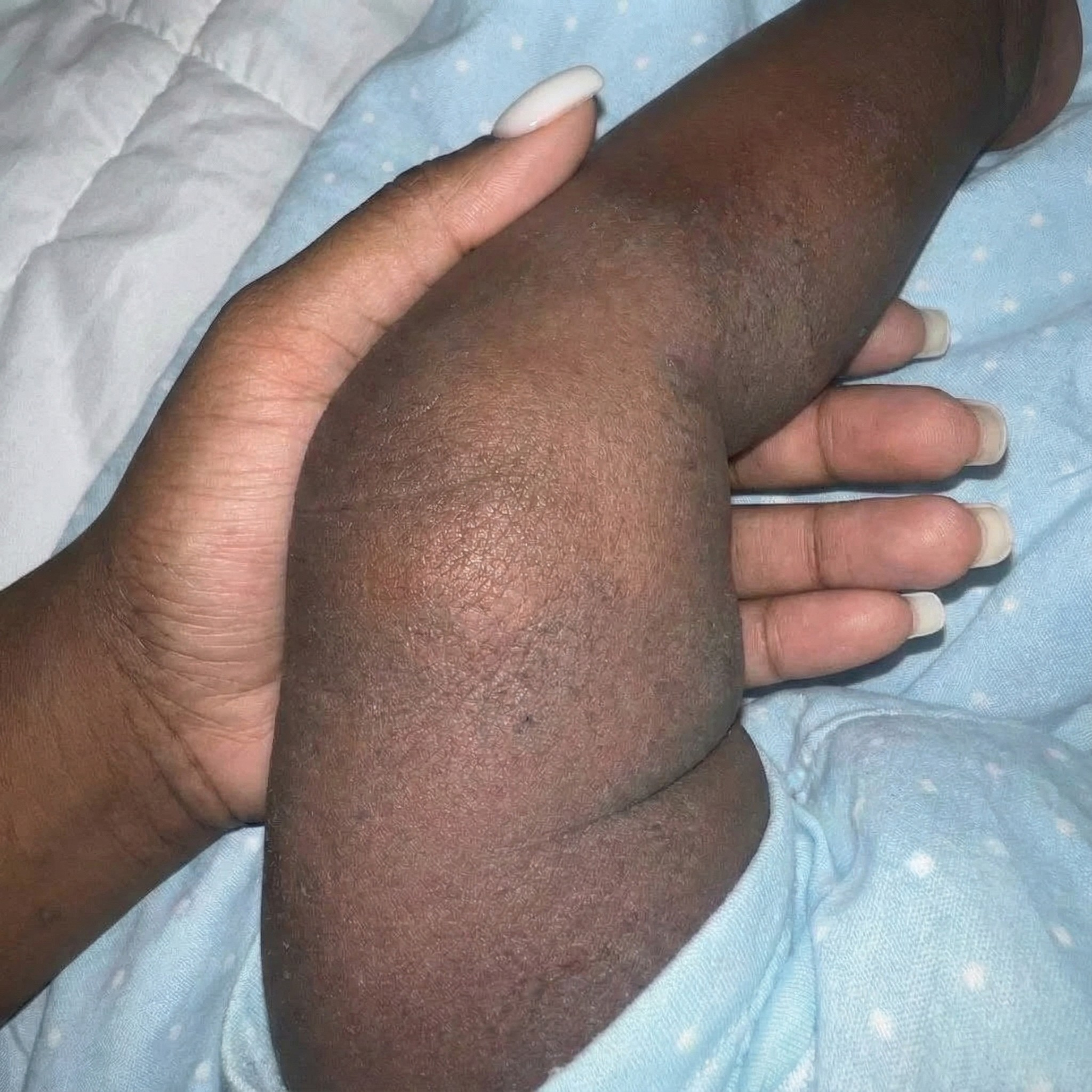 Ruth Henderson Facebook ad: Read this if your baby has eczema
